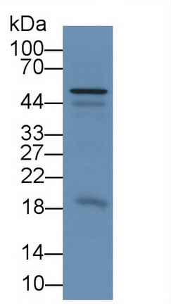 Chemerin (CHEM) Rat Monoclonal Antibody