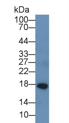 Chemerin (CHEM) Rat Monoclonal Antibody