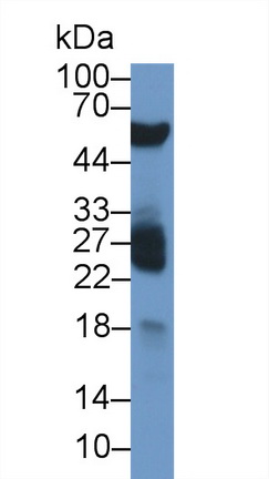 Chemerin (CHEM) Rat Monoclonal Antibody