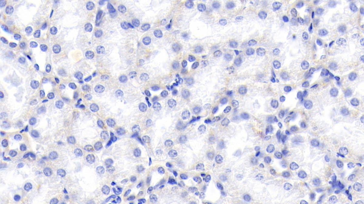 Chemerin (CHEM) Rat Monoclonal Antibody