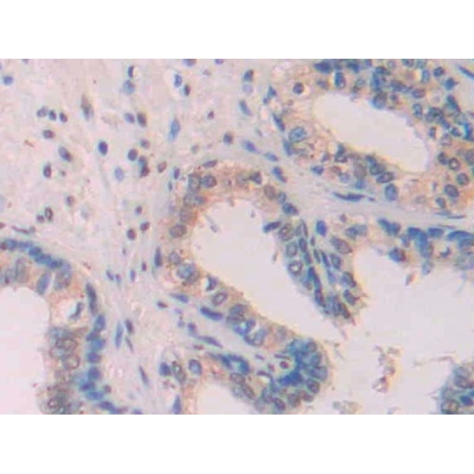 Amyloid Beta Peptide 1-42 (Ab1-42) Human Monoclonal Antibody