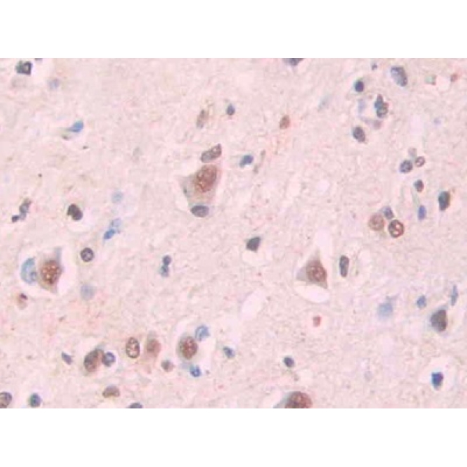 Amyloid Beta Peptide 1-42 (Ab1-42) Human Monoclonal Antibody