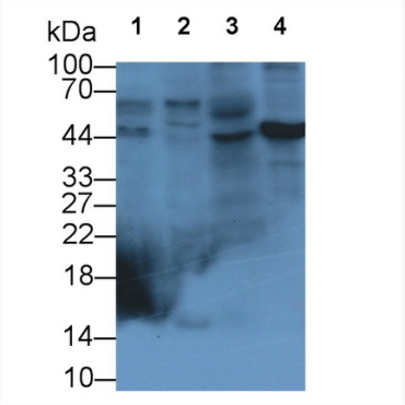 Glypican 3 (GPC3) Human Monoclonal Antibody