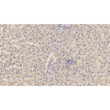 Glypican 3 (GPC3) Human Monoclonal Antibody