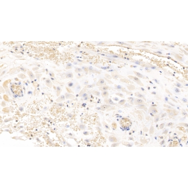 Glypican 3 (GPC3) Human Monoclonal Antibody