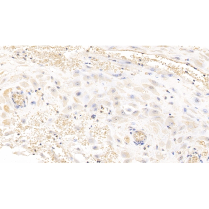 Glypican 3 (GPC3) Human Monoclonal Antibody