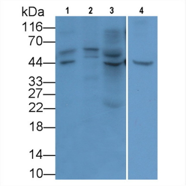 Glypican 3 (GPC3) Human Monoclonal Antibody
