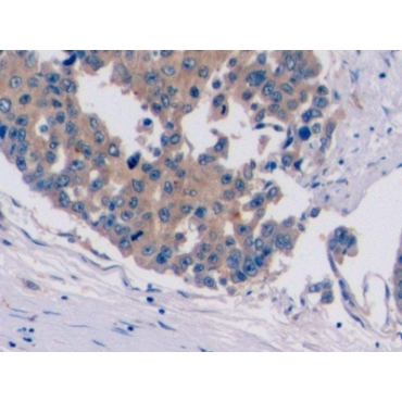 Glypican 3 (GPC3) Human Monoclonal Antibody