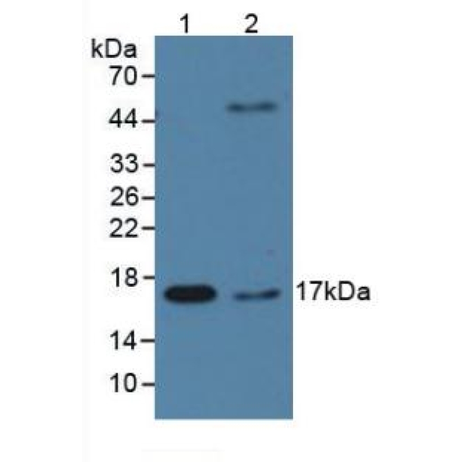 Cyclophilin A (CYPA) Human Monoclonal Antibody