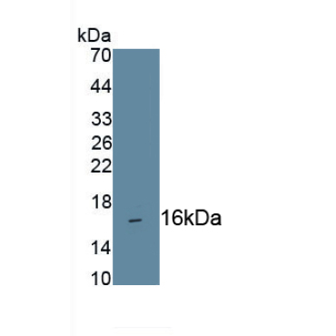 Cluster Of Differentiation 160 (CD160) Human Monoclonal Antibody