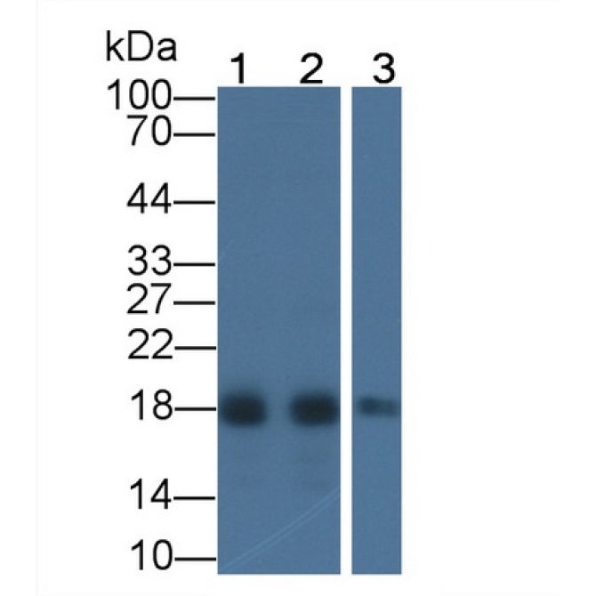Acid Phosphatase 1 (ACP1) Human Monoclonal Antibody