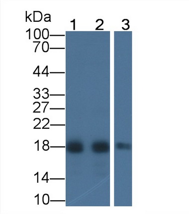 Acid Phosphatase 1 (ACP1) Human Monoclonal Antibody