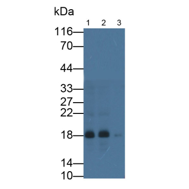 Acid Phosphatase 1 (ACP1) Human Monoclonal Antibody