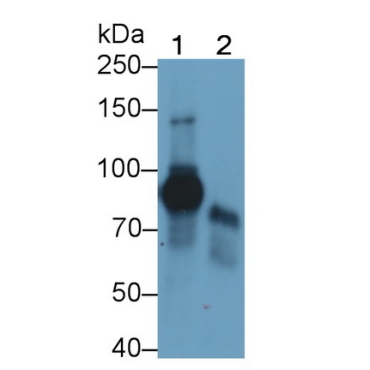 Low Density Lipoprotein Receptor Related Protein 1 (LRP1) Human Monoclonal Antibody