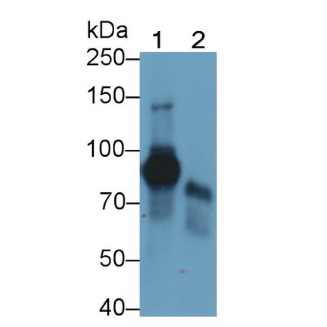 Low Density Lipoprotein Receptor Related Protein 1 (LRP1) Human Monoclonal Antibody