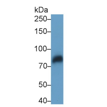 Low Density Lipoprotein Receptor Related Protein 1 (LRP1) Human Monoclonal Antibody
