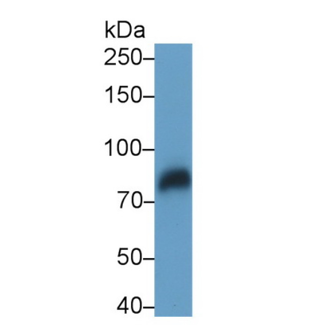 Low Density Lipoprotein Receptor Related Protein 1 (LRP1) Human Monoclonal Antibody