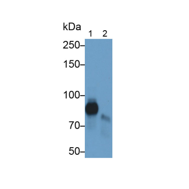 Low Density Lipoprotein Receptor Related Protein 1 (LRP1) Human Monoclonal Antibody