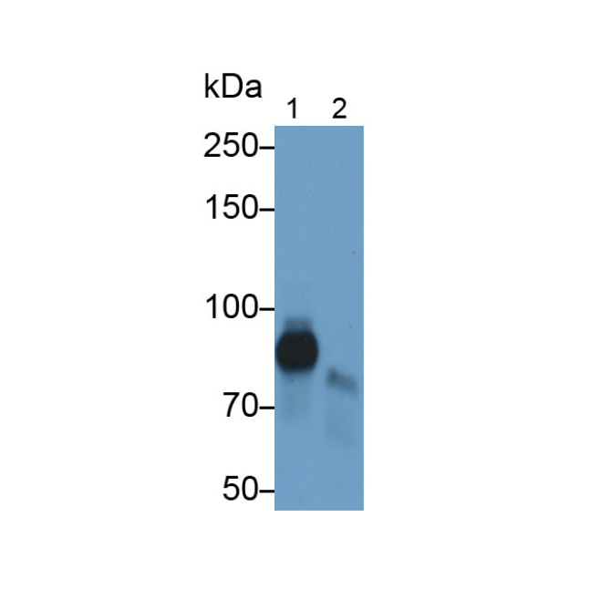 Low Density Lipoprotein Receptor Related Protein 1 (LRP1) Human Monoclonal Antibody