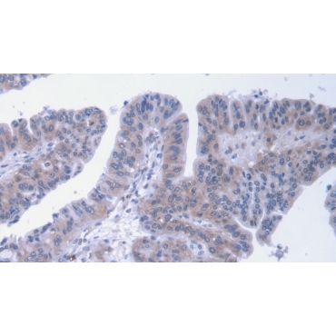 Alpha-2-Macroglobulin (a2M) Human Monoclonal Antibody