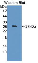 Alpha-2-Macroglobulin (a2M) Rat Monoclonal Antibody