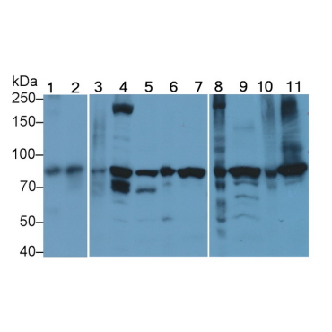 Beta Catenin (Beta-catenin) Human Monoclonal Antibody