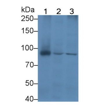 Beta Catenin (Beta-catenin) Human Monoclonal Antibody