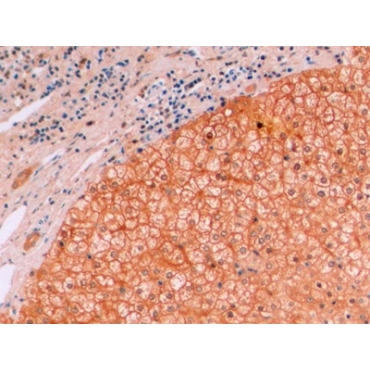 Beta Catenin (Beta-catenin) Human Monoclonal Antibody