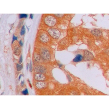 Beta Catenin (Beta-catenin) Human Monoclonal Antibody