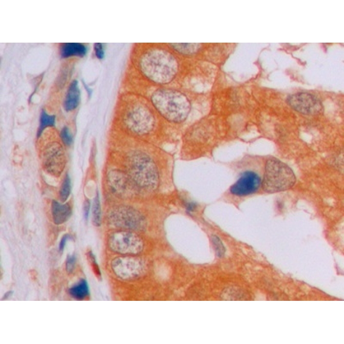Beta Catenin (Beta-catenin) Human Monoclonal Antibody