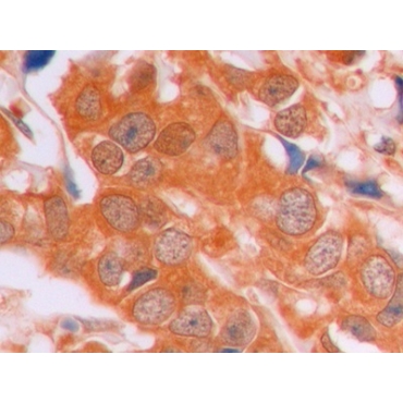 Beta Catenin (Beta-catenin) Human Monoclonal Antibody