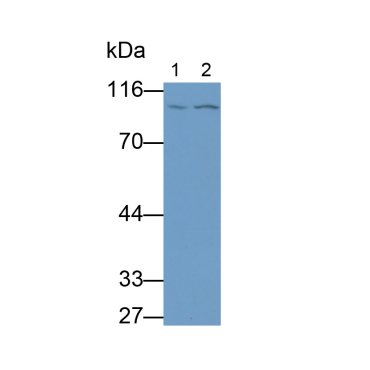 Beta Catenin (Beta-catenin) Human Monoclonal Antibody