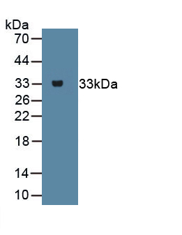Beta Catenin (Beta-catenin) Rat Monoclonal Antibody