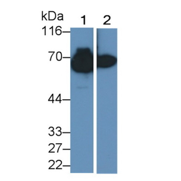 Albumin (ALB) Human Monoclonal Antibody