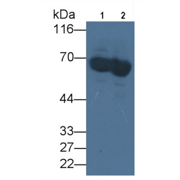 Albumin (ALB) Human Monoclonal Antibody