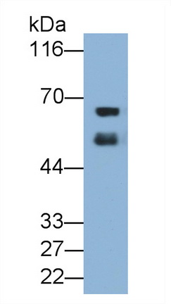 Albumin (ALB) Rat Monoclonal Antibody
