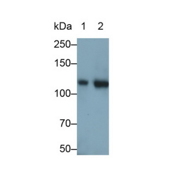 Integrin Alpha 2B (ITGa2B) Human Monoclonal Antibody