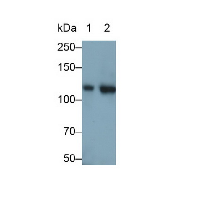 Integrin Alpha 2B (ITGa2B) Human Monoclonal Antibody