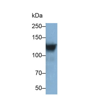 Integrin Alpha 2B (ITGa2B) Human Monoclonal Antibody