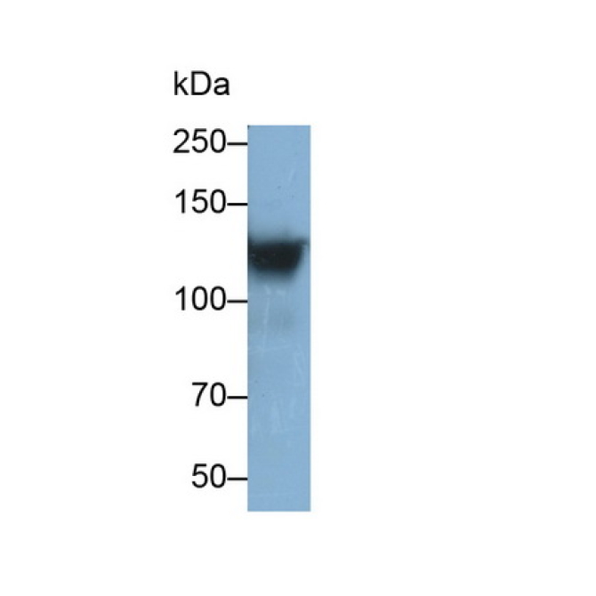 Integrin Alpha 2B (ITGa2B) Human Monoclonal Antibody