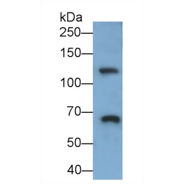 Integrin Alpha 2B (ITGa2B) Human Monoclonal Antibody