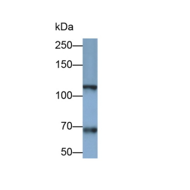 Integrin Alpha 2B (ITGa2B) Human Monoclonal Antibody