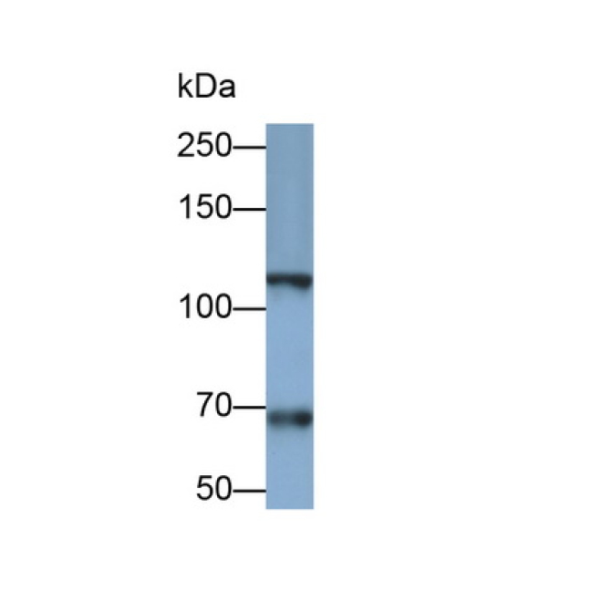 Integrin Alpha 2B (ITGa2B) Human Monoclonal Antibody