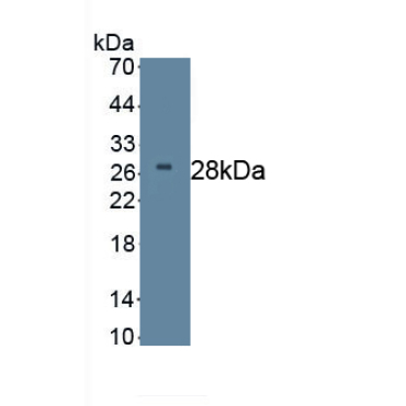 Dickkopf Related Protein 2 (DKK2) Human Monoclonal Antibody