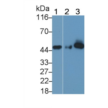 Surfactant Associated Protein D (SPD) Human Monoclonal Antibody