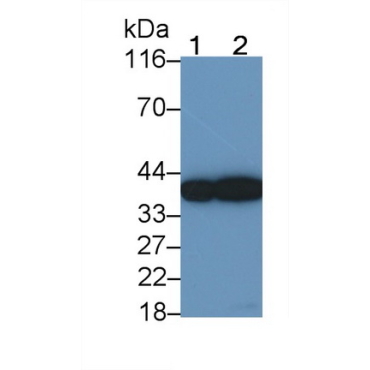 Surfactant Associated Protein D (SPD) Human Monoclonal Antibody