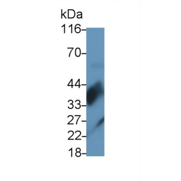 Surfactant Associated Protein D (SPD) Human Monoclonal Antibody