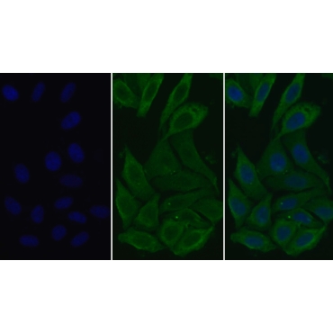 Surfactant Associated Protein D (SPD) Human Monoclonal Antibody