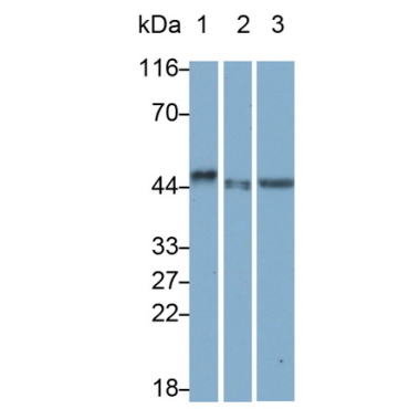 Surfactant Associated Protein D (SPD) Human Monoclonal Antibody