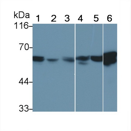 Vimentin (VIM) Human Monoclonal Antibody